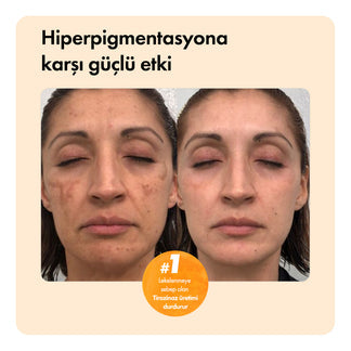Sonuç Odaklı ™ Vegzera Temizleme Sabunu