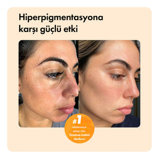 Sonuç Odaklı ™ Vegzera Temizleme Sabunu