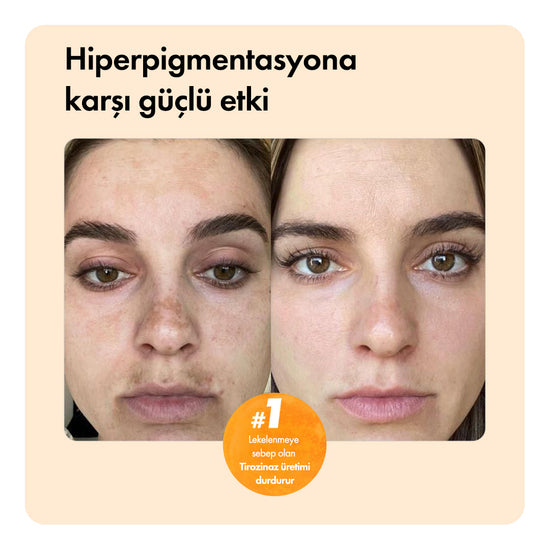 Sonuç Odaklı ™ Vegzera Temizleme Sabunu